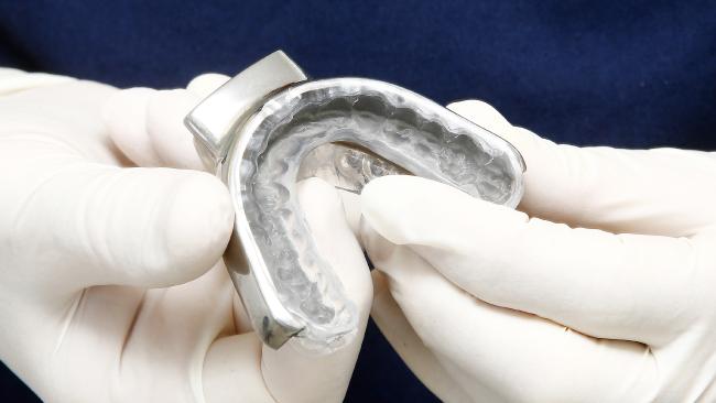 Our new 3D-printed titanium mouth guard device for sleep apnoea