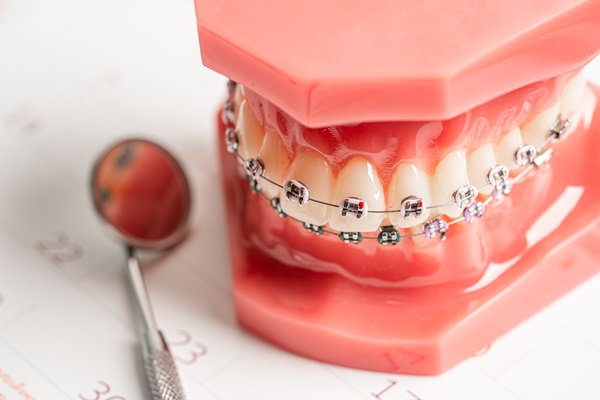 Dentist equipment, dental instrument, tools for dental professio