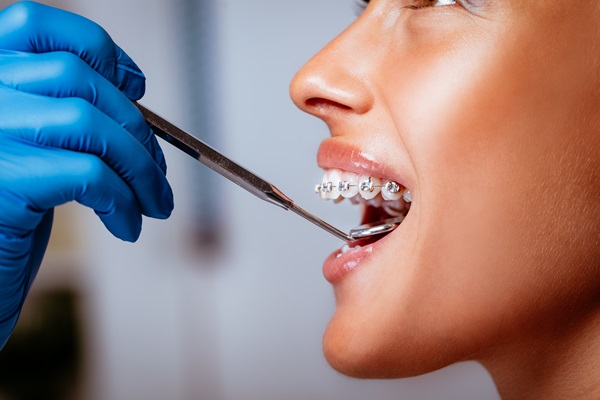 Smiling Woman At Dentist