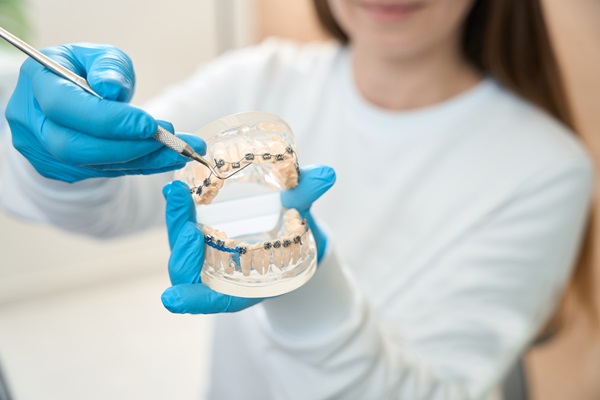 Dentist hygienist holds model dentition with braces in his hands