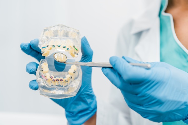 dental jaw model in hands of stomatologist in latex gloves