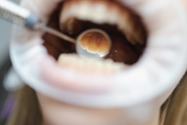 Close-up dental mirror in the mouth. Macro photography of the process of examining teeth