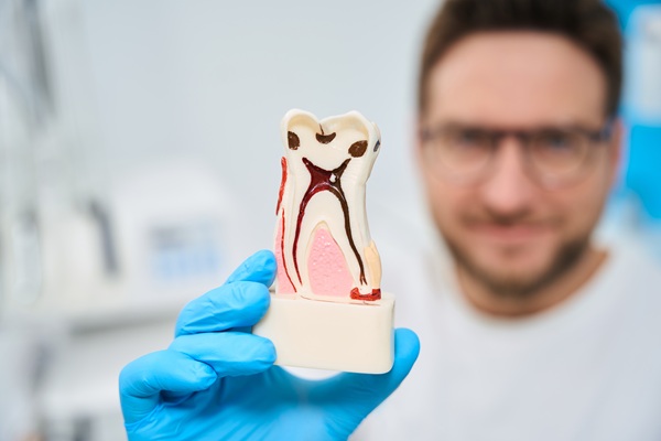 Man dentist in uniform holding 3d model of tooth obturation