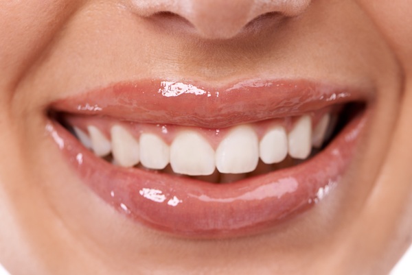 perfect smile with composite bonding