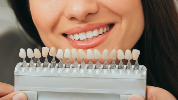 teeth palette with different shades of teeth near female smiling. veneers