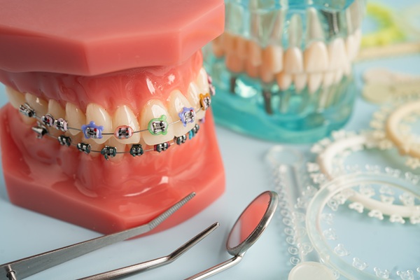 Orthodontic ligatures rings and ties, elastic rubber bands on orthodontic braces, model for dentist studying about dentistry.