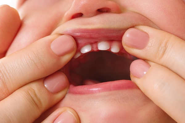 Closeup shot of a mother opening her little child's mouth with freshly erupted deciduous teeth