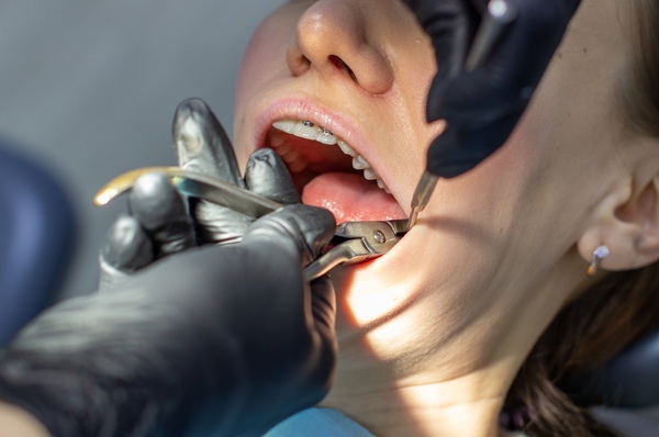 A woman with dental braces visits an orthodontist at the clinic doing tooth extraction