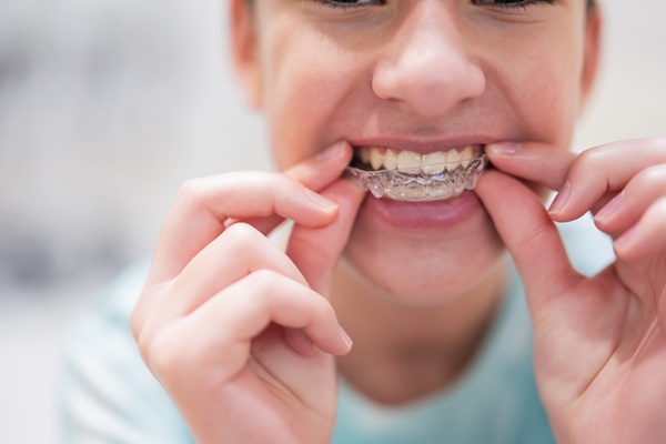 Teenager boy wear simulator orthodontic silicone invisible leveling braces for teeth. Dental concept, orthodontics.