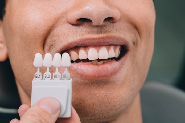 Dentist showing the color of the teeth bonding