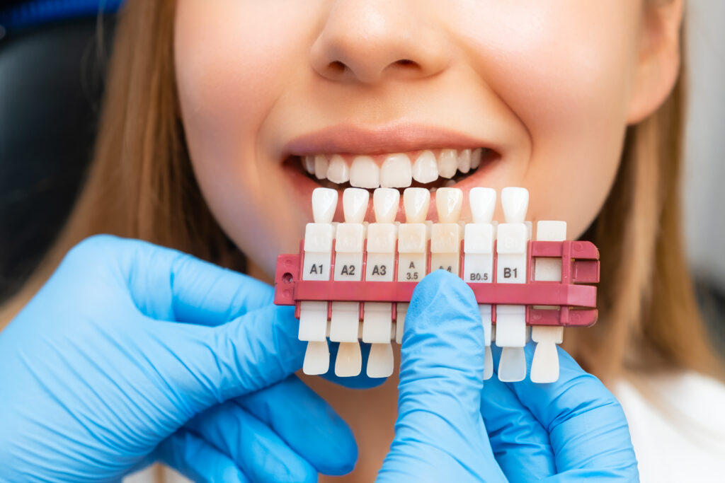 Dentist holding a tooth shade guide against a patient's smile to check how long teeth whitening lasts