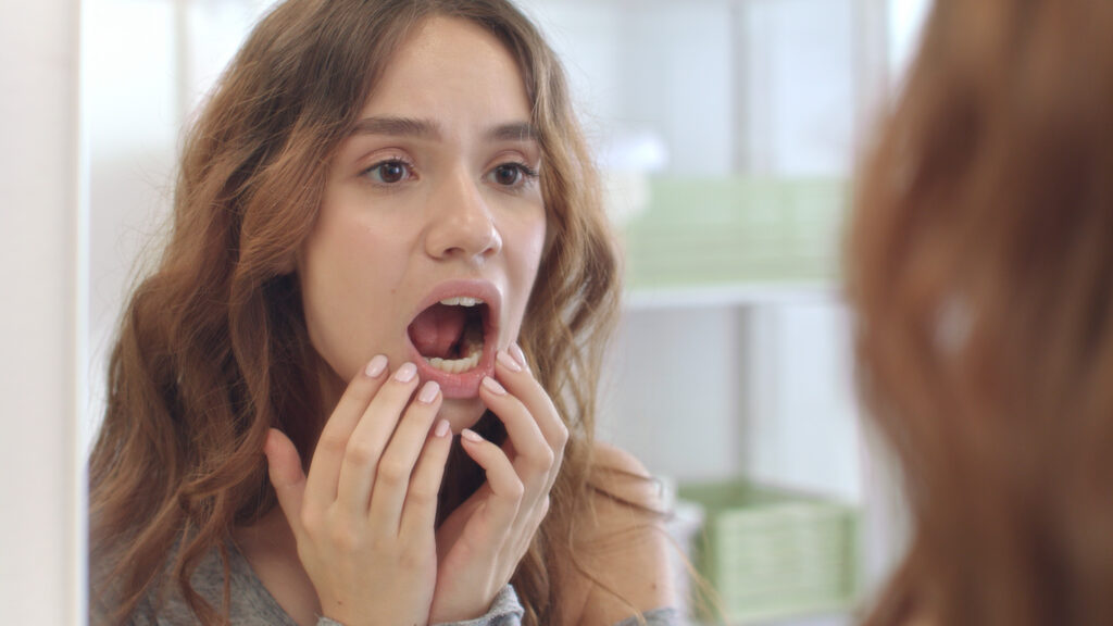 Young woman looking in a mirror with her mouth open, pulling down her lower lip to check her teeth and gums for signs of a tooth abscess