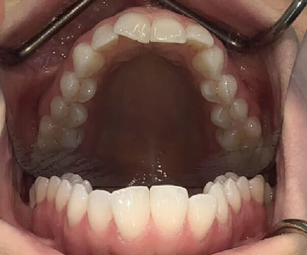 Teeth 3 (1)