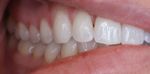 Teeth 4 (1)