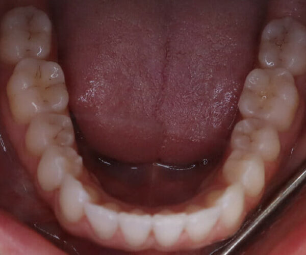 Teeth 5 (1)